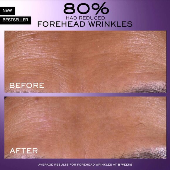 Lancôme Rénergie C.R.X. Triple Serum w/ Anti-Aging Retinol 50mL | NEW SKINCARE - Picture 4 of 5